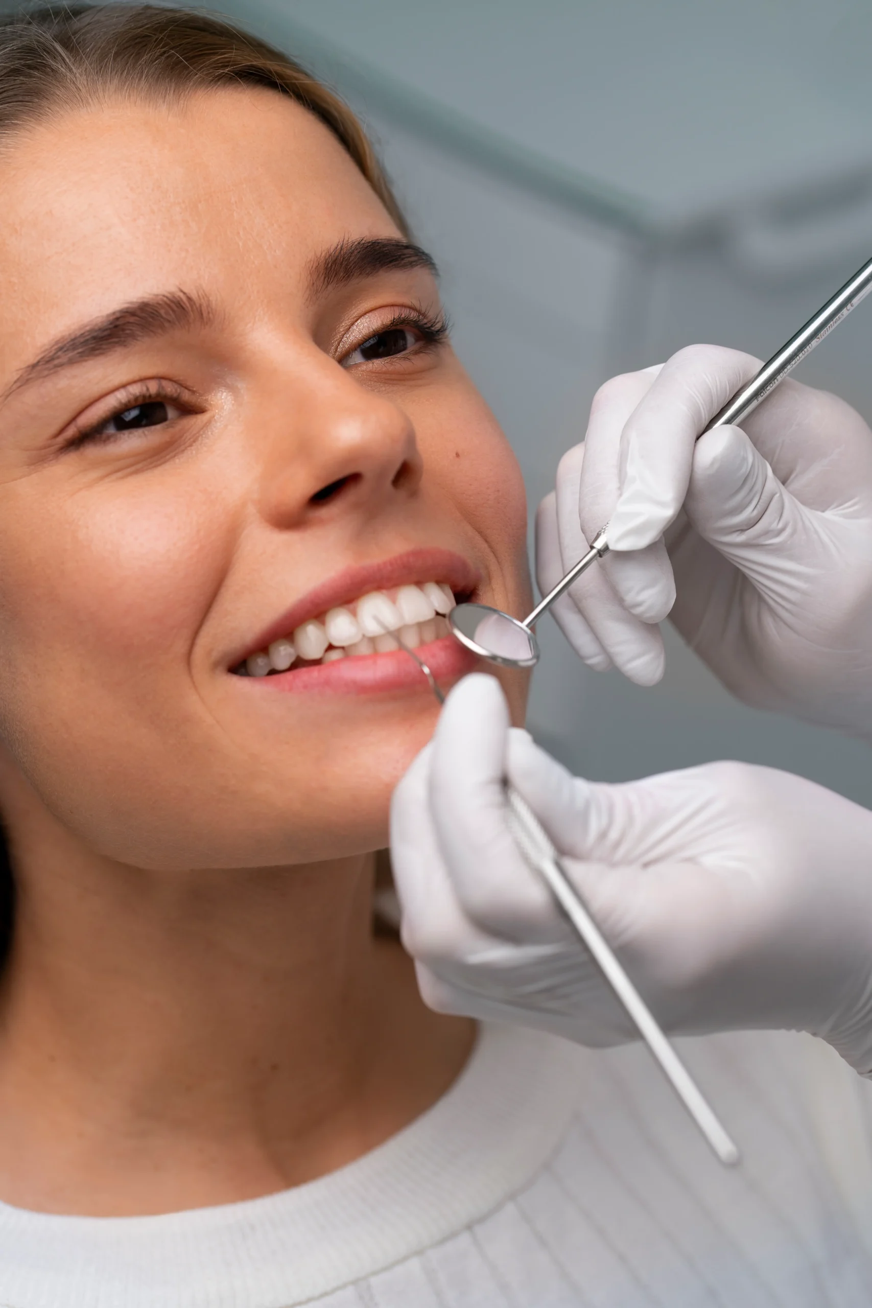 Blanqueamiento Dental